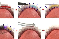 Medicul curant gingiilor