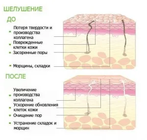 Chimie Peel - reintinerirea pielii naturale - rețete