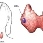 лечение заболяване на щитовидната жлеза и превенция