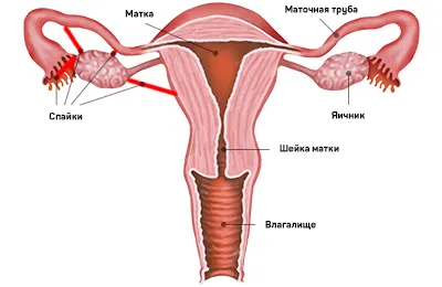 Lupta activă cu crampoane