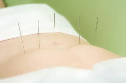 Ce este acupunctura la fel de des efectua procedura în cazul în care există contraindicații cu acupunctura