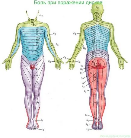 По гърба или гръбначните (обратно) херния дискове L4-L5, L5-s1 и други нива на лечение, диагностика