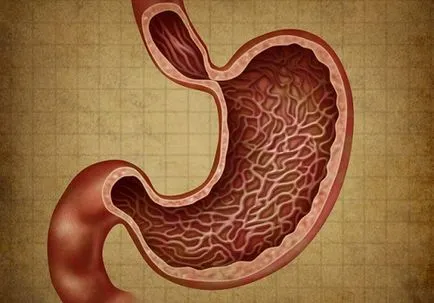 gastrită și metode de normalizare a stomacului eritematoase