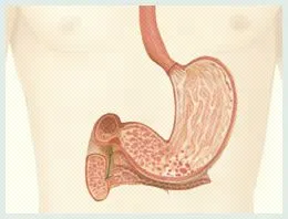 Gastroduodenitis, duodeno-gyomorrefluxot (DGR), krónikus, felületes, GERD - tünetek és