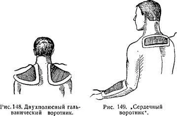 Галванична яка на Шчербак