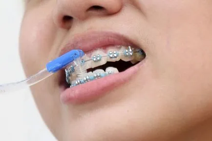 irigator igienă orală cu bretele, periuta de dinti, pasta de dinti si apa de gura