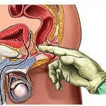 Hogyan lehet megtalálni a prosztata, és vizsgáljuk meg