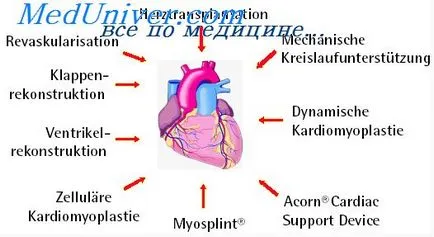 Diagnosticul diferențial de astm cardiac