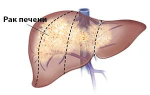 Как да спечелите титан сянка битка 2 на затъмнението (най-лесният начин)