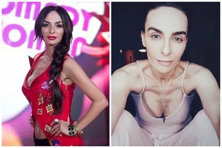 Ekaterina Varnava előtt és után plasztikai sebészet fotók és videó
