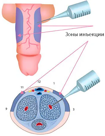 Medicamente pentru disfuncția erectilă la bărbați