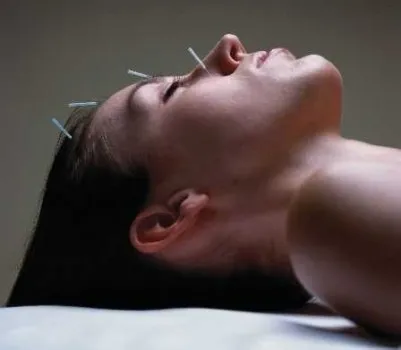 Kezelésére különböző típusú neurózisok akupunktúra
