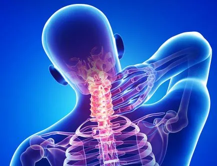 A kezelési módszerek a nyaki gerinc instabilitás