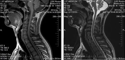 MRI nyirokcsomók Moszkva árakat MRI, a nyaki, lágyéki nyirokcsomókat