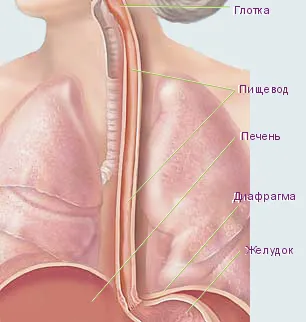 Нарушаването на поглъщане след инсулт - Лечение на сърдечна