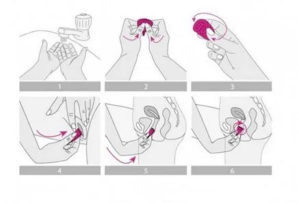 Плюсове и минуси на използването на менструалния чаша