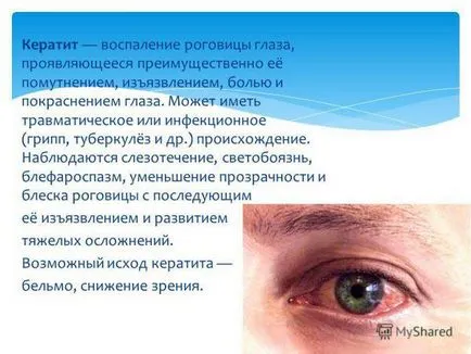 Înroșirea proteinelor cauzează ochiului și tratamentul la adulți și copii, pielea din jurul mâncărime, sclera