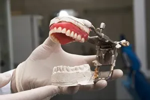 Polipropilén fogsor - polipropilén protézis fogak