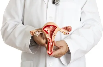 Polip in tratamentul uterului fara chirurgie si chirurgie, poate fi vindecată