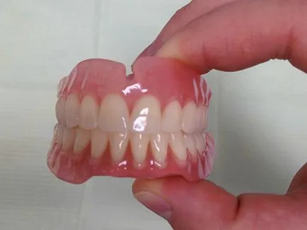 Edentulous зъболечение, причини, симптоми, видове, диагностика и профилактика