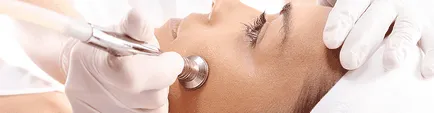 Diamond peeling „- Biztonságos arcfiatalítás