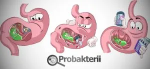 A Helicobacter pylori gastritis okait és patológiás állapotok kezelésére