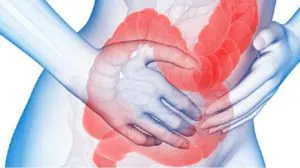 Sindromul de colon iritabil Tratamentul