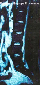 Diagnostice coloanei vertebrale (Kiev) »spine❺