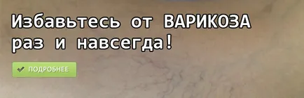 Dr. Agapkin visszerek a legfontosabb, a visszértágulatok kezelésében