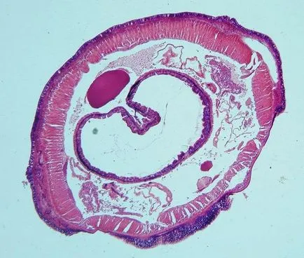 Râmă sub microscop