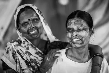 Indiai lányok fizetnek a szépség, a vonakodás, hogy feleségül