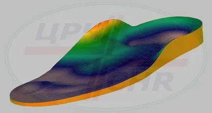 Производство на индивидуални ортопедични стелки в Москва - клиника CDP