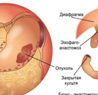 Cum pentru a curăța stomac la domiciliu