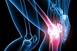 Hogyan lehet felismerni arthritis ízületek