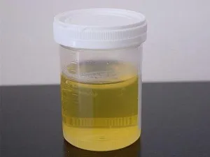Tratamentul prostatitei urina si argila pro si contra