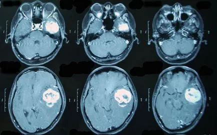 MRI с разлика - какво е това, как да се направи, цената на контрастни вещества