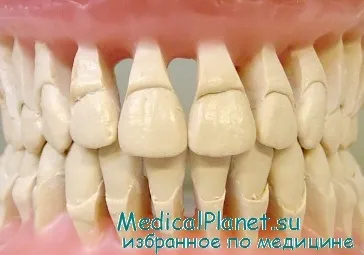 Szövődményei kezelésére malocclusion