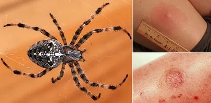 Araneus Spider daca muscatura este periculos pentru oameni