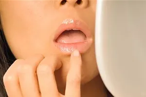 De ce buzele uscate la femei, bărbați și copii, care provoacă uscăciunea gurii, ce să facă