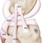 Decalajul a ligamentelor genunchiului - Simptome, tratament și reabilitare