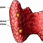 Mérgező adenoma a pajzsmirigy - azaz okoz, kezelés műtét nélkül