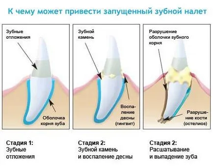 Eltávolítása (tisztítás) fogászati ​​ultrahangos kövek kutyáknál