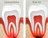 като се излиза от списък на болести