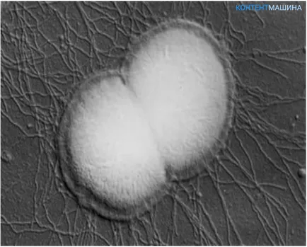 Pirulák, antibiotikumok, kúpok, injekciók és gyógyszerek kezelésére gonorrhea férfiaknál