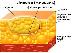 Вън лазерна видео, цени, коментари