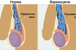 обучение Узи скротум, стандарти и декодиране