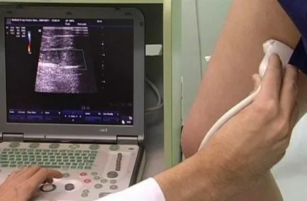 Cu ultrasunete a venelor membrelor inferioare tehnica diagnostic