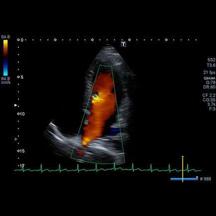 Ultrasound Scanner toshiba Xario 200