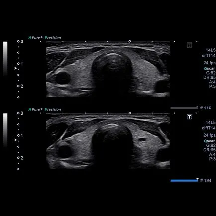 Ultrasound Scanner toshiba Xario 200