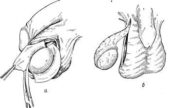 Boli ale testiculelor - pagina 4, reducerea mashonki în cazul în care scrot la barbati fotografie